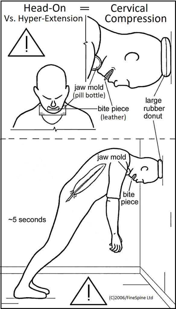 Cervical Compression