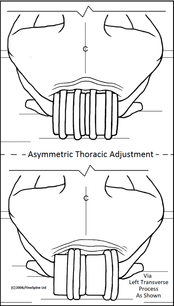 Thoracic Adjustment